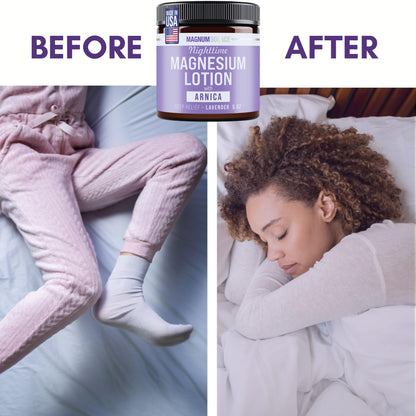 Magnum Solace Nighttime Magnesium Lotion with Arnica - Highly Concentrated Magnesium