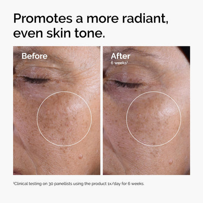 The Ordinary Glycolic Acid 7% Exfoliating Toner – Brightening & Smoothing Face Toner