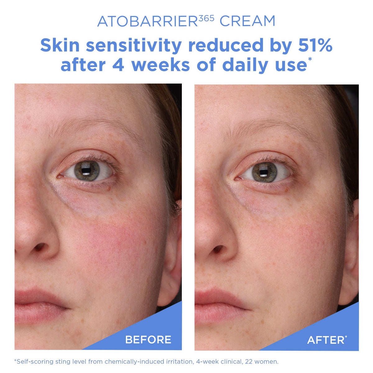 AESTURA ATOBARRIER365 Cream with Ceramides, Korean Face Moisturizer for Barrier Repair - 120H lasting Hydration, Ceramide Capsules