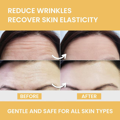 MONIER Forehead Wrinkle Patches Smoothing Overnight - Anti Wrinkle Patches - For Face And Forehead Fine Lines & Frown Lines, With Aloe, Collagen, Vitamin E, Hyaluronic Acid, 12 Pcs